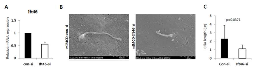 Ift46 유전자의 감소로 인한 ciliogenesis 변화 관찰