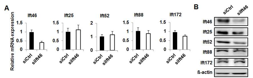 Ift46 발현 감소가 IFT B compolex 발현에 미치는 영향 검증