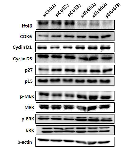 Ift46 발현 감소가 cell cycle과 관련된 단백질들 발현 조절에 미치는 영향 검증