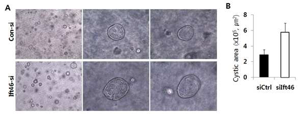 Ift46 발현의 감소가 낭포 형성에 미치는 영향 검증