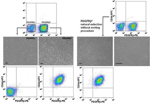 콜라겐 분화유도기법을 이용한 혈관주위전구세포 분화 유도된 세포의 특성분석 (Kim et al., 특허출원, 논문게재 예정)