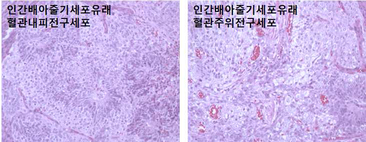 인간배아줄기세포유래 혈관내피전구세포와 혈관주위전구세포의 장기간 안전성 확인