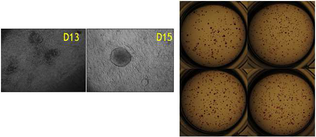 Dox 처리 후 일자별 pre-iPSC 콜로니 형성 모습(왼쪽). 4-well culture dish에서 AP 염색(오른쪽).
