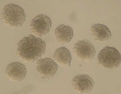 iPSC 콜로니. 유리관을 이용하여 picking 한 모습. 개별 콜로니 분석에 사용. 평균(~2500 cells) 이상 크기의 콜로니는 제거.