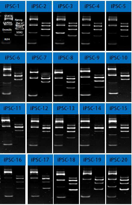 iPSC 콜로니 분석. stemness 유전자 PCR products 밴드위치를 iPSC-1에 표시. 8% PAGE.