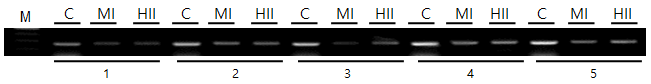 control 실험. 제한효소자리가 없는 부위를 PCR. C, undigested control; MI, MspI digested DNA; HII, HpaII-digested DNA.