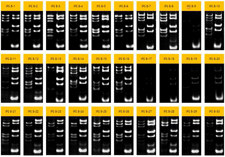 4F2A piPSC 콜로니의 유전자 발현 프로파일. PAGE 정기영동 사진.