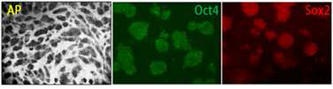 테라토마 유래 3차 iPSC 콜로니 면역형광염색.
