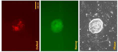 RFP(DsRed)-expressing TOF- derived iPSC colony. Nanog-promoter- driven GFP.