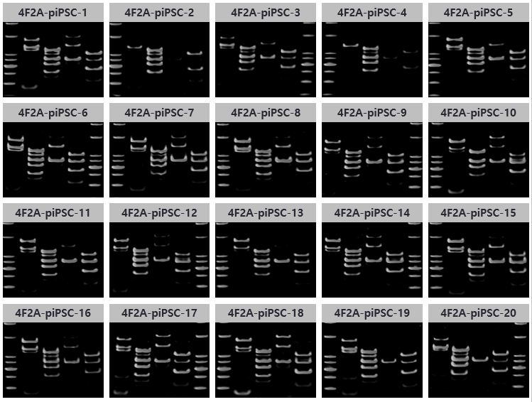 4F2A pre-iPSC 콜로니의 유전자 발현 프로파일. PAGE 사진