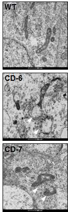 전자현미경 을 통한 시트린결핍 간세포에서의 미토콘 드리아 형태