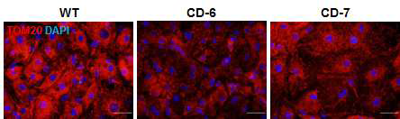 시트린결핍 간세포에서의 TOM20 단백질 발현과 분포
