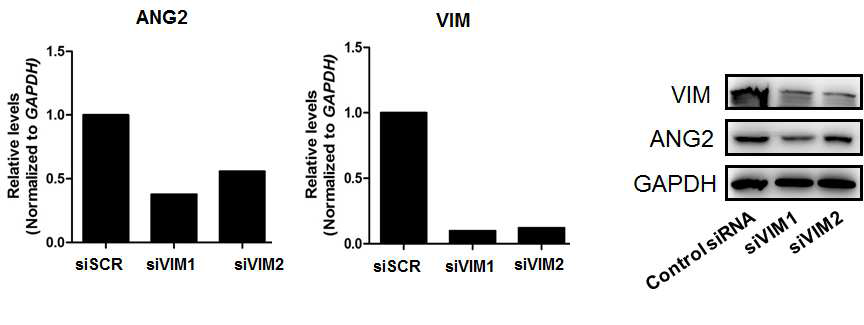 siRNA를 사용해 중간섬유를 Knock down 시켰을 때의 혈관생성 인자들의 변화