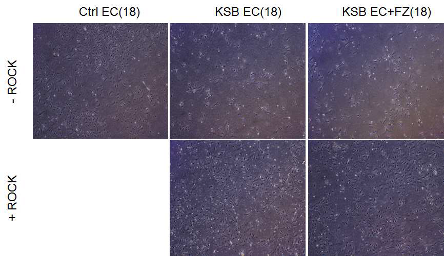 Rock inhibitor를 처리하였을 때 환자 혈관내피세포의 형태학적 변화