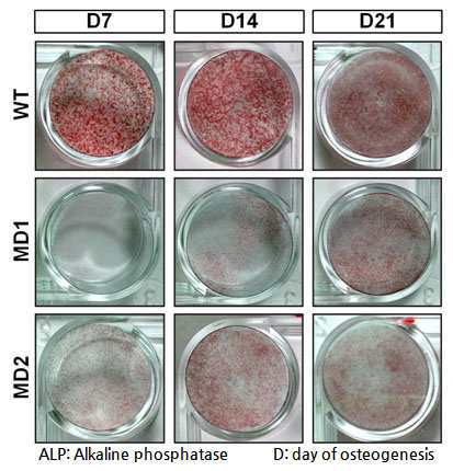골세포분화과정에서의 ALP의 활성변화