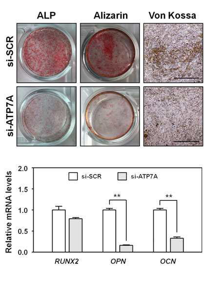 ATP7A의 발현감소로 인한 골세포형성 이상