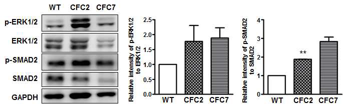 CFC 증후군 특이적 역분화줄기세포에 유도한 골세포에서 증가해 있는 p-ERK1/2와 p-SMAD2