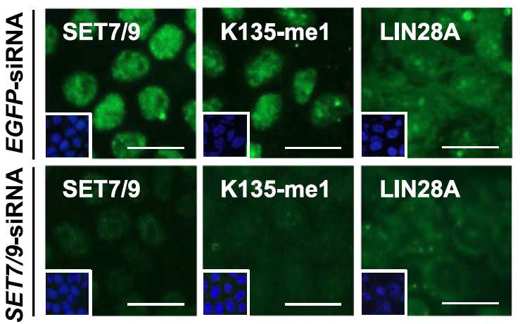 SET7/9이 감소하면 핵에서의 LIN28A 메틸레이션이 감소한다는 사실을 면역 형광염색법을 통해 관찰함