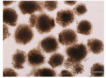 헤파린-카테콜/콜라겐 1(HepC-Col-P6) 코팅 표면에서 25번 계대 된 인간 배아줄기세포로부터 제작된 Embryonic bodies (EBs)