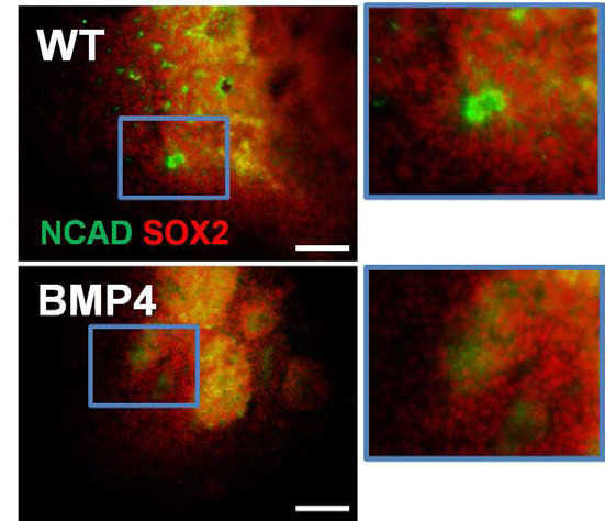 CRL 역분화줄기세포에 BMP4 처리 후 신경로 제트 형성 비교