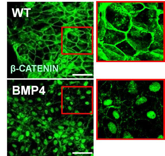 CRL 역분화줄기세포에 BMP4 처리 후 b-catenin의 localization 비교