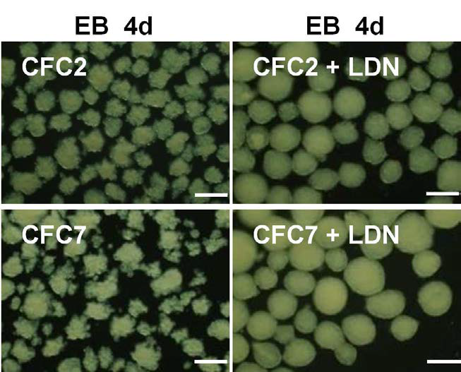 CFC 역분화줄기세포의 EB 형성과정에서 LDN 처리 후 EB가 깨지는 문제를 해결