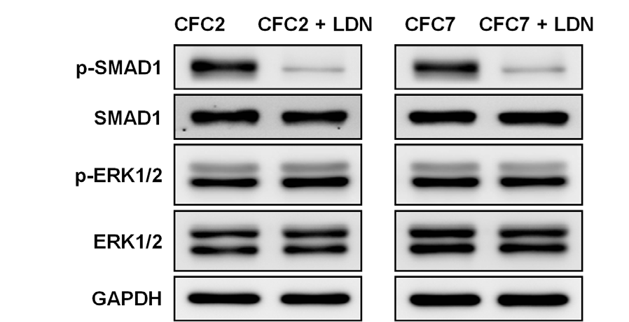 CFC 역분화줄기세포의 EB 형성과정에서 LDN 제대로 작용했는지 p-SMAD1 감소를 통해 확인