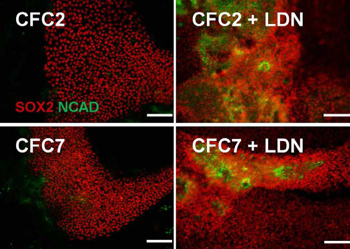 CFC 역분화줄기세포의 초기 신경로제트 형성 시 LDN 처리 후 신경로제트 형성이 제대로 일어나는 것을 관찰