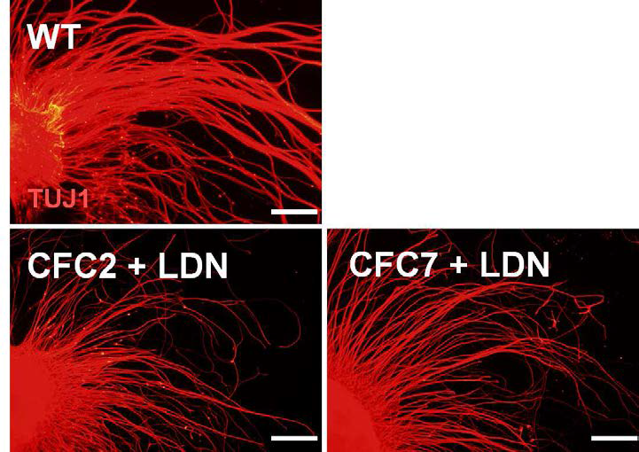 CFC 역분화줄기세포가 신경으로 분화하여 신경돌기가 제대로 생기는지 확인하기 위해 TUJ1 발현 양상을 관찰