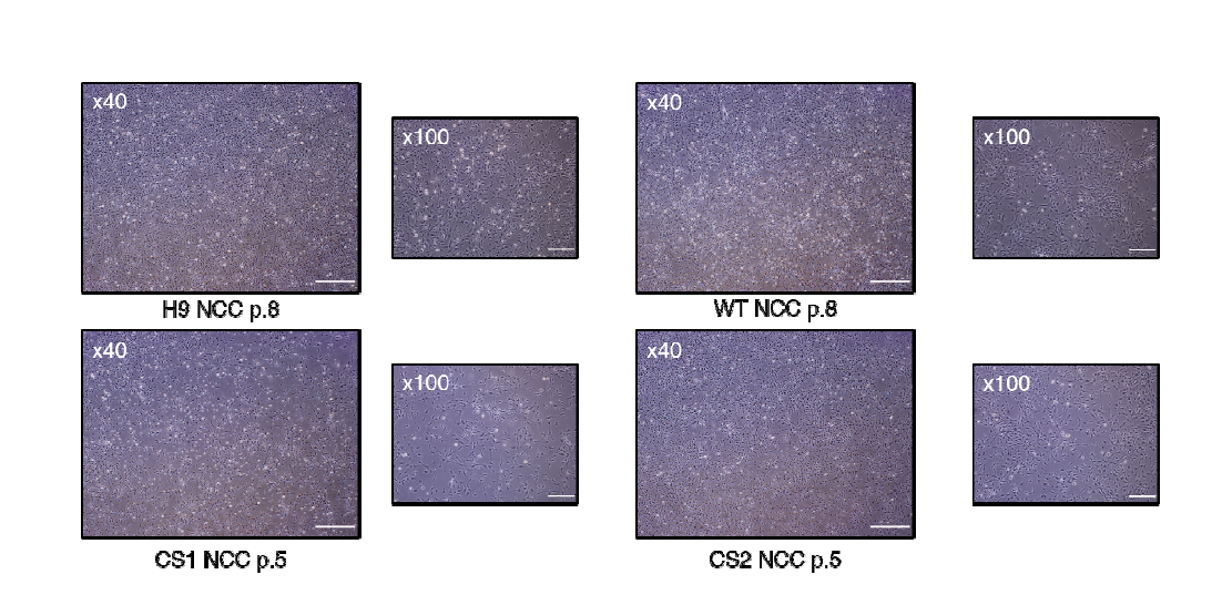 배아줄기세포, 정상 체세포 유래 iPSC, 환자 체세포 유래 iPSC에서 분화된 neural crest cell의 morphology