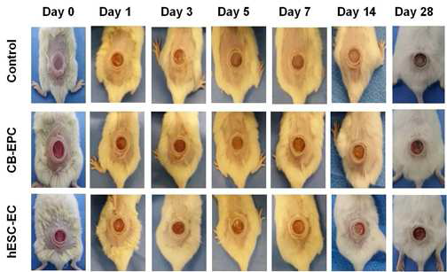 인간화생쥐의 창상회복 진행 사진