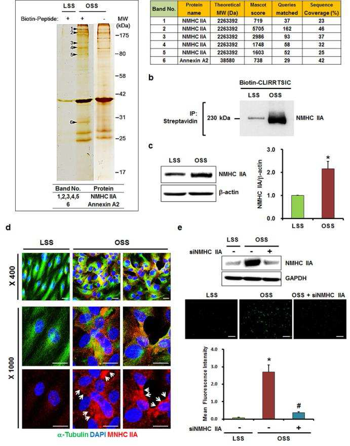 선별된 CLIRRTSIC peptide의 표적 단백질로서 Non-muscle myosin heavy chain IIA (NMHC IIA) (2세부와 연계연구로 진행)