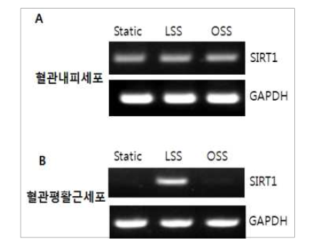 혈류전단응력 변화에 따른 SIRT1의 mRNA 변화