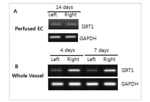 마우스 와이어 혈관손상 모델에서 SIRT1의 발현 변화