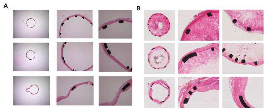 스텐트가 삽입된 Rat 대동맥의 H&E 염색 결과