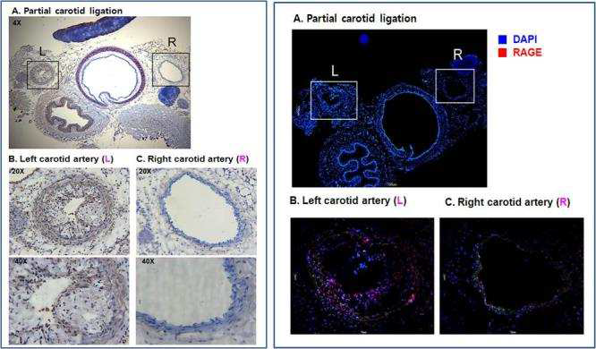 경동맥 결찰 모델에서 혈류변화에 의한 RAGE의 발현도