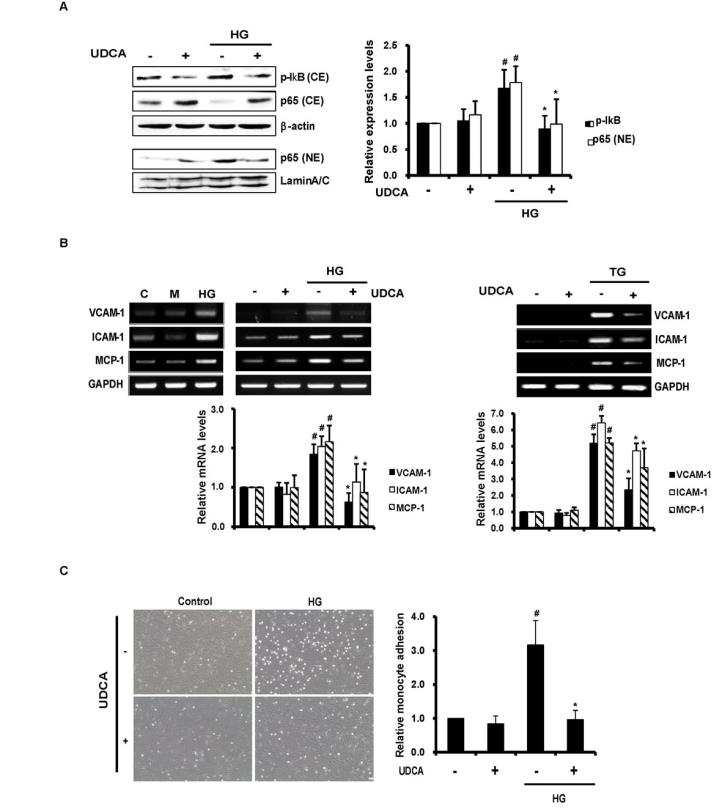 혈관내피세포에서 고혈당에 의한 NF-kB 활성화에 대한 UDCA의 영향