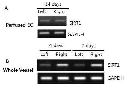 마우스 와이어 혈관손상 모델에서 SIRT1의 발현 변화
