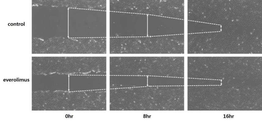 Wound healing assay with miR-145 compare with control and everolimus.