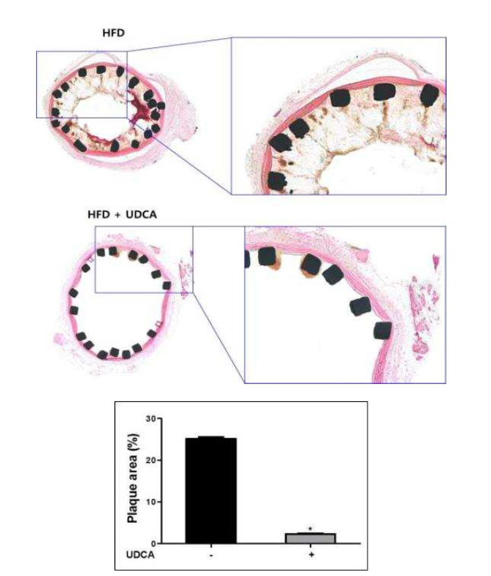 스텐트 삽입 후 재협착에 대한 UDCA의 재협착 억제 효과