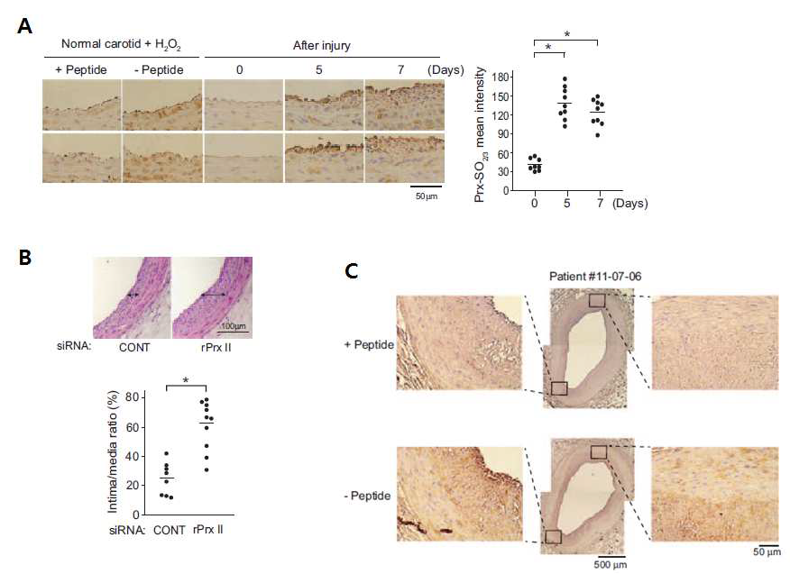 A. balloon-injurd 혈관이 리모델링 되어가는 과정에서 Prx-SO2/3 발현증가 를 확인한 IHC 사진 및 정량 그래프, B. PrxII 특이적으로 발현 저해한 혈관 경우 대 조군에 비해 두꺼워진 혈관 내막 관찰, C. 동맥경화 환자 샘플에서 증가된 Prx-SO2/3 발현 확인.