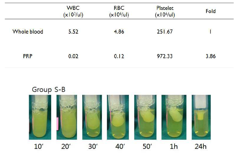 혈액과 PRP 내 혈소판 개수 비교트롬빈 활성화에 따른 PRP 젤 형성