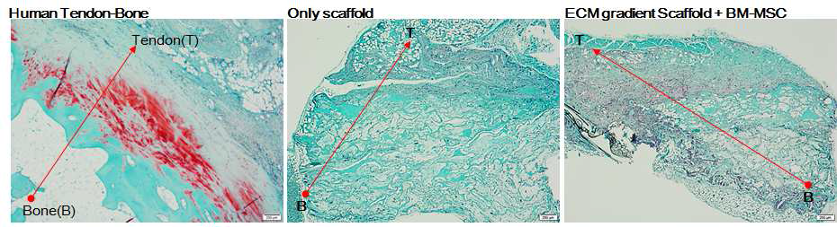 인간 건-골 조직과 줄기세포 부착 지지체의 건-골 인터페이스 재생 비교