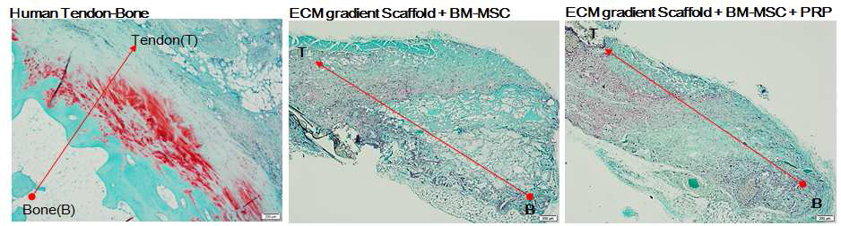 인간 건-골 조직, 마우스 이식 줄기세포-그레디언트 지지체-PRP 복합체의 건-골 인터페이스 재생 비교