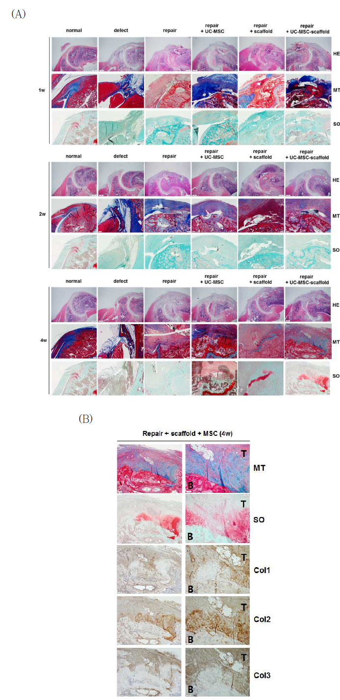 렛트의 회전근개 질환 모델의 단층형 그레디언트 지지체-줄기 세포의 건-연골-골 그레디언트 인터페이스 형성능 분석
