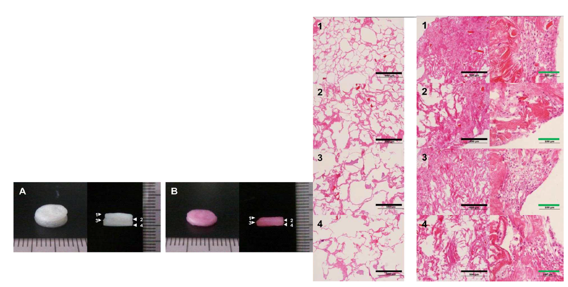 vitro 상 그레디언트 지지체 접착 및 세포 생존 확인 (28일 세포 배양 후).