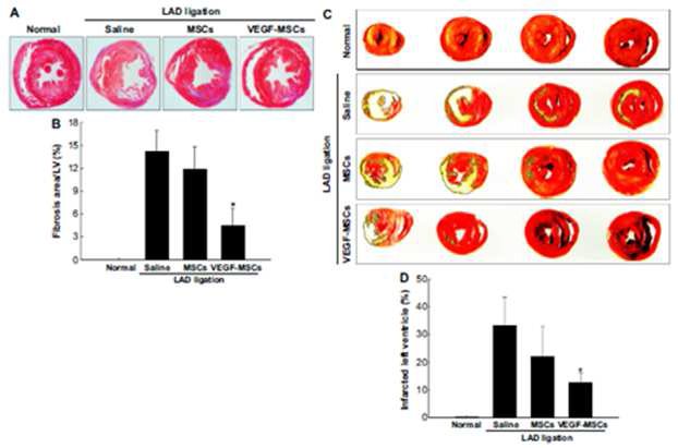 허혈심근 부위로 이식된 허혈성 특이적 발현 VEGF-MSCs에 의한 섬유화 경색부위 감소효과