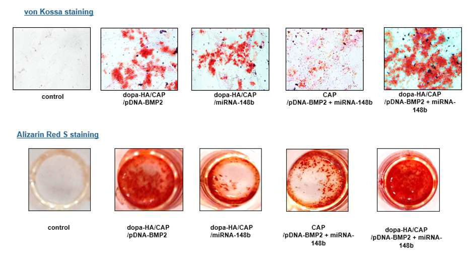 miR-148b를 BMP-2 발현 plasmid DNA와 함께 전달시 골분화 시너지효과: bone-specific staining