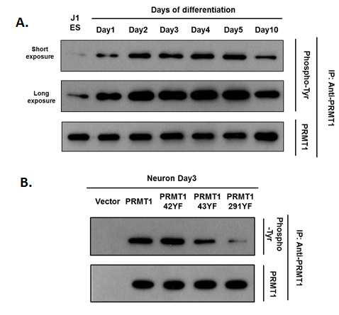 PRMT1 또는 PRMT1 point mutation form이 과발 현된 J1ES cell 에서의 인산화 정도 확인