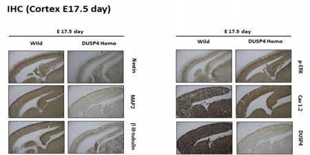 DUSP4 knock-down embryo 의 대뇌 피질에서의 신경세포 관련 단백질 의 발현 패턴 확인
